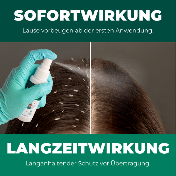 Silberkraft Kopfläusespray 100 ml, Effektiver Läuseschutz für Kopfhaut und Haare, Läuse zuverlässig vorbeugen, Läuseabwehr für Kinder geeignet