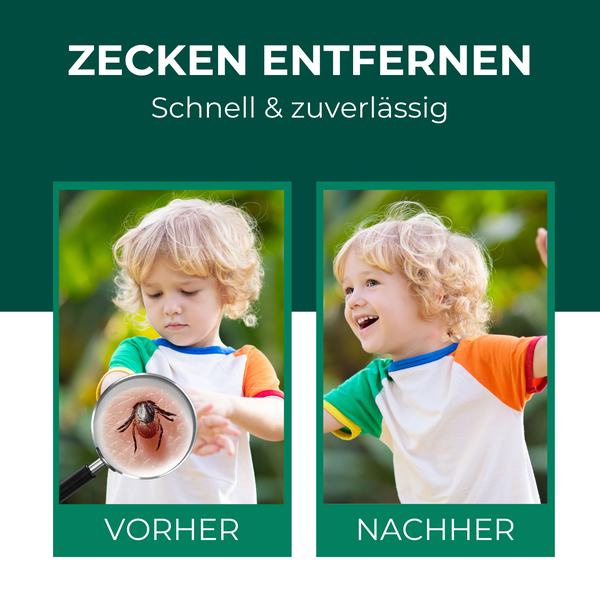 Zeckenzange für Hunde und Katzen, geeignet für Zuhause und Unterwegs