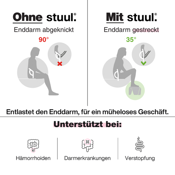 Infografik zum stuul Toilettenhocker: Vergleich von 90 Grad und 35 Grad Sitzposition. Hilft bei Haemorrhoiden, Darmerkrankungen und Verstopfung.
