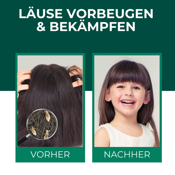 Silberkraft Kopfläusespray 100 ml, Effektiver Läuseschutz für Kopfhaut und Haare, Läuse zuverlässig vorbeugen, Läuseabwehr für Kinder geeignet