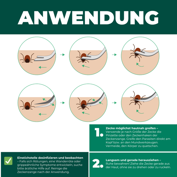 Zeckenzange aus Edelstahl mit Aufbewahrungstasche